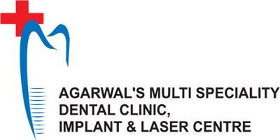 Ahmedabad Dental-Agrawal Dentist
